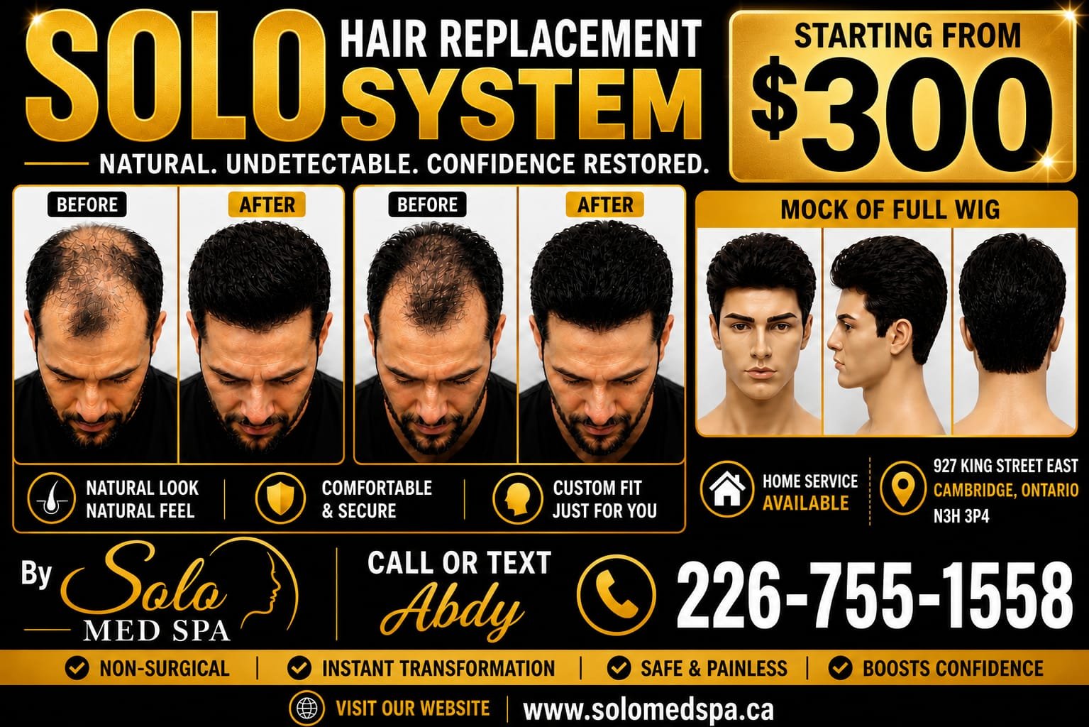Hair Replace